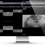 Dental-Imaging-Versity-Dental-1
