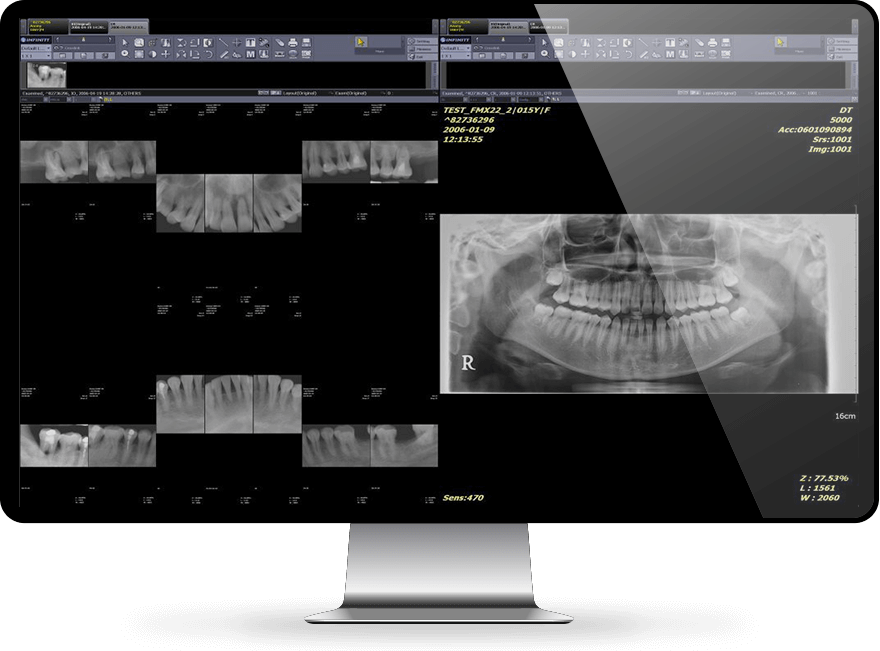 Dental-Imaging-Versity-Dental-1