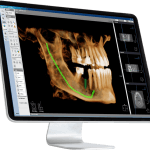 INFINITT-Xelis-Dental-Brochure-_-645x580px
