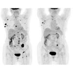 RjVfUEVUQ1Qgb25jb2xvZ3lfVFJJT19TQ1A_