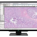 CL-S1200thum_pathology