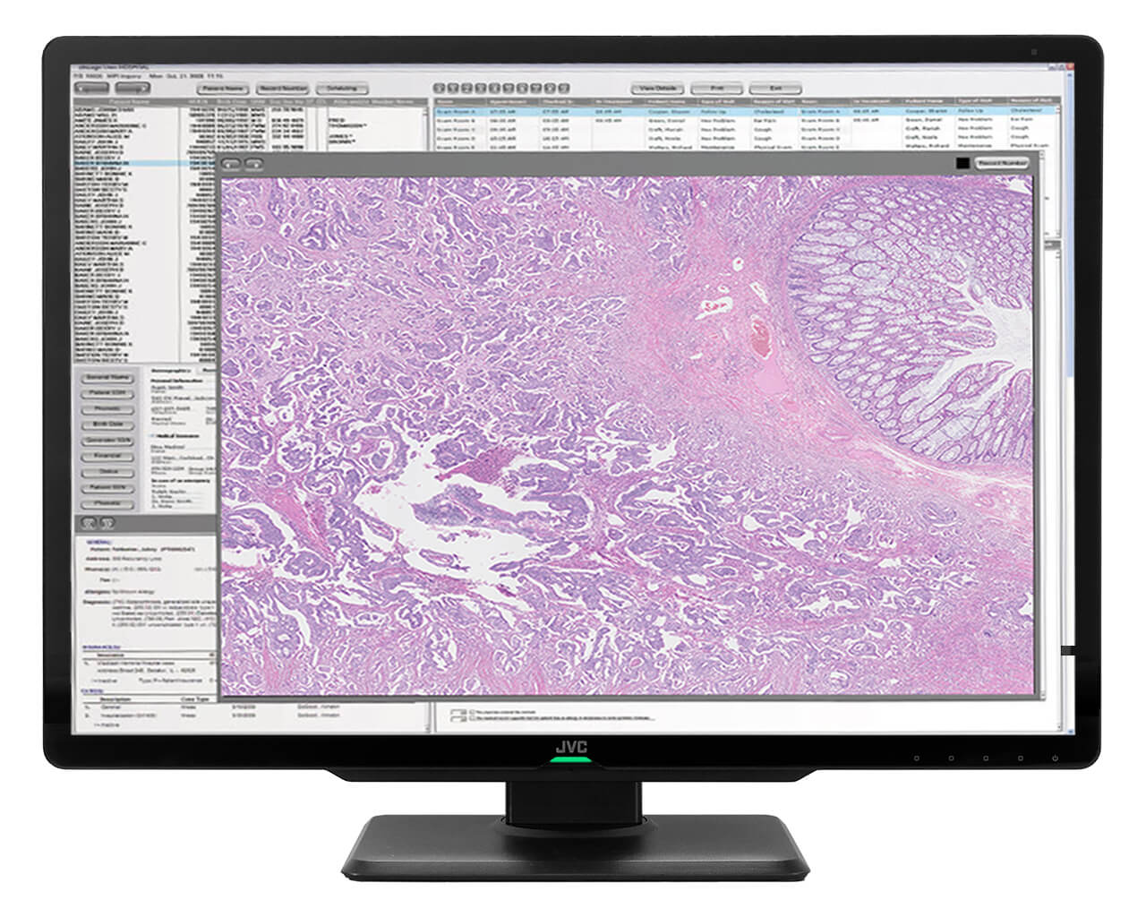 CL-S1200thum_pathology