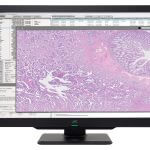 CL-S600thum_pathology