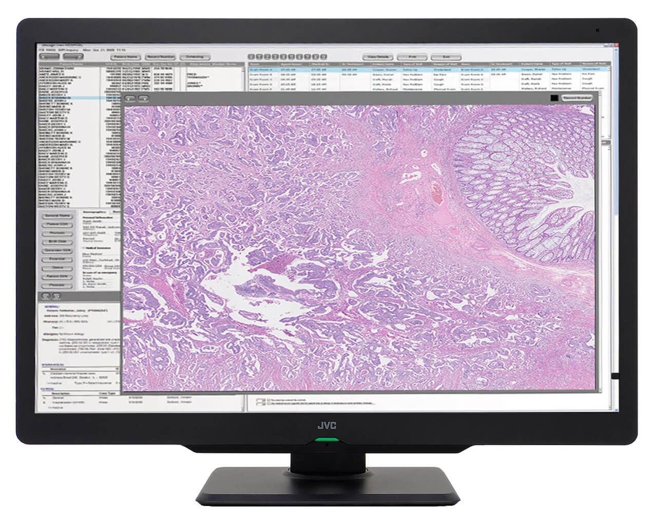 CL-S600thum_pathology