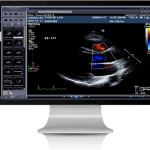 Cardio-PACS-585x435px