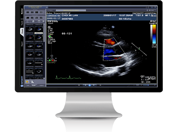 Cardio-PACS-585x435px