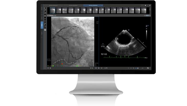 INFINITT-Cardiology-PACS_IJP