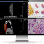 MDT-Screen