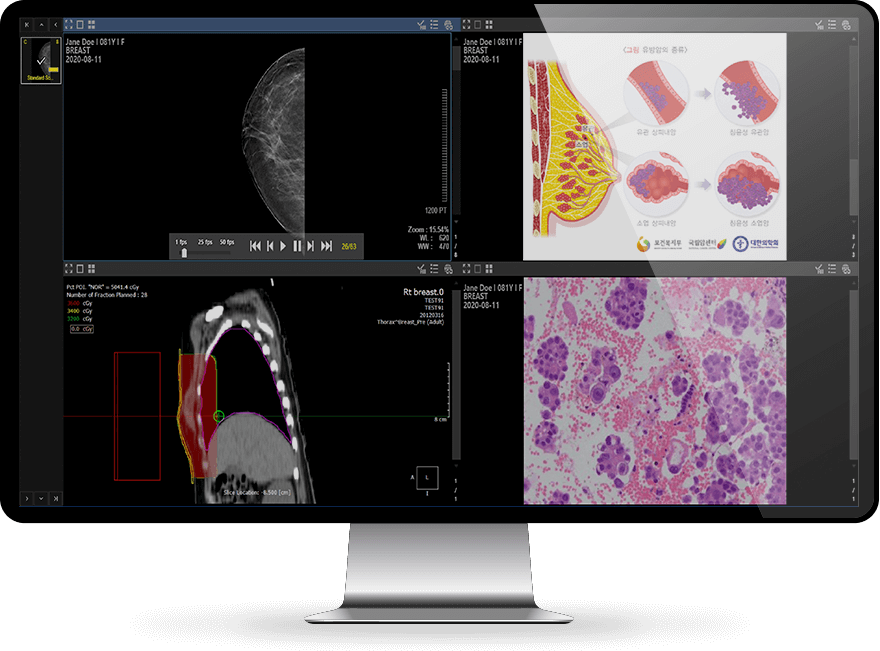 MDT-Screen