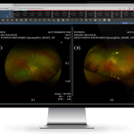 Ophth-FUNDUS-OD-OS-Monitor