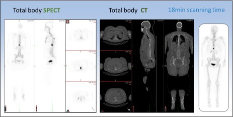 Spectrum Dynamic - Veriton Sieries (3)