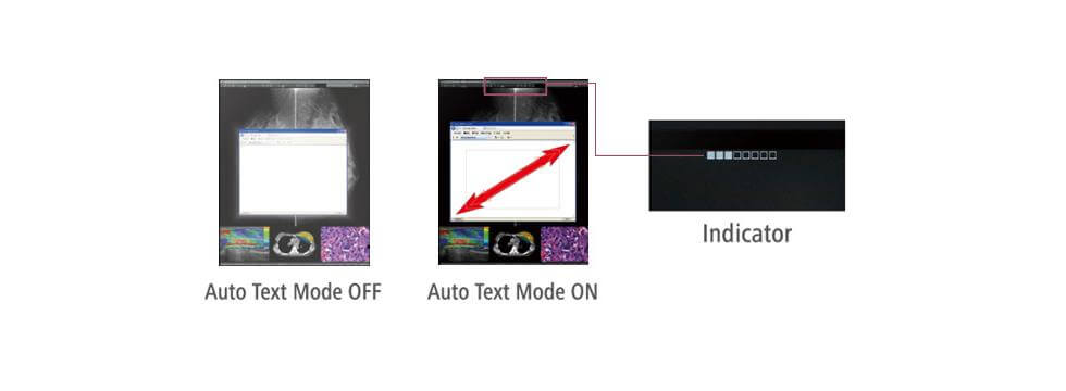 auto-text-mode