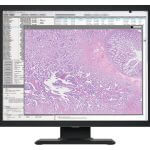 i3thum_pathology