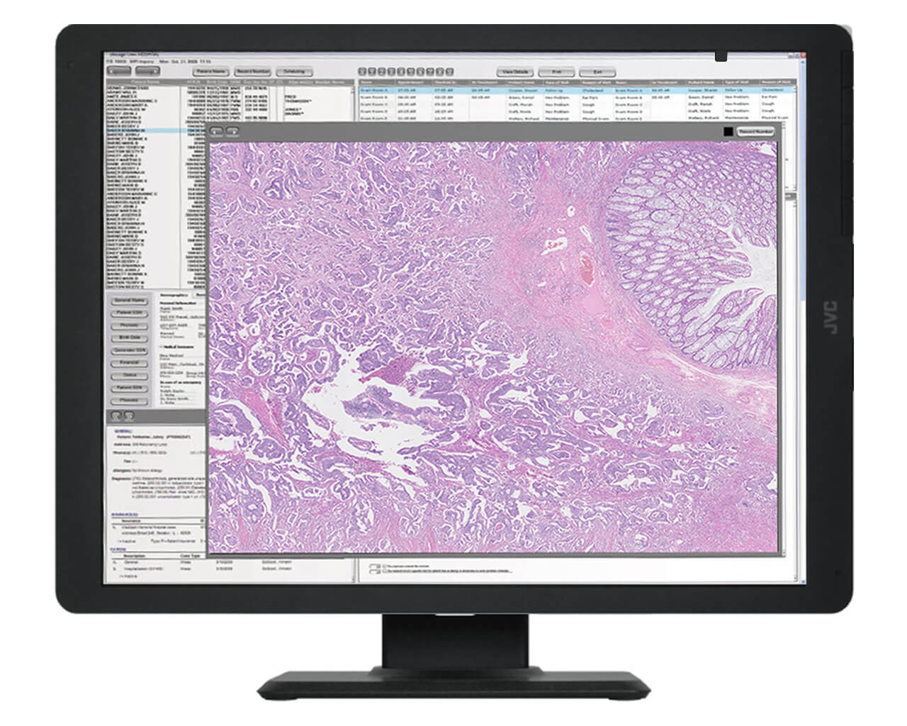 i3thum_pathology